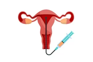 IUI Icon